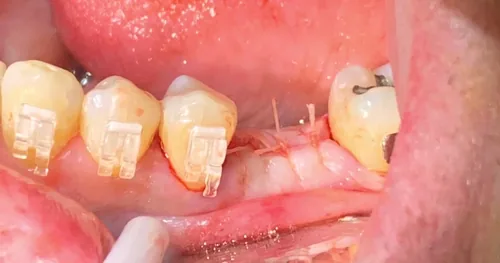 Harmony Dental Studio, consultorio dental en Tijuana, Baja California