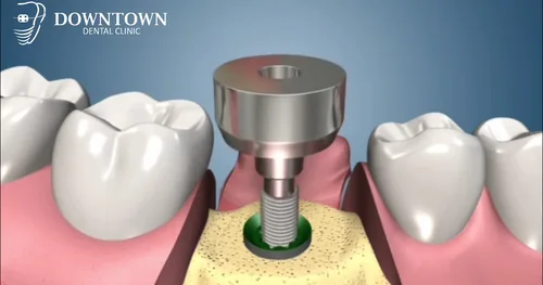 Downtown Dental Clinic, consultorio dental en Tijuana, Baja California