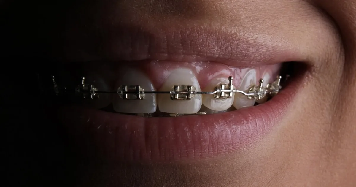 Dr. Arturo Valencia / DENTISTA / Brackets y más. (Ortodoncia)