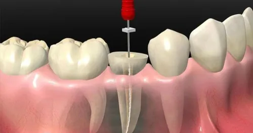 Dr. Daniel Garcia Silva, Dentista – Odontólogo, consultorio dental en Saltillo, Coahuila