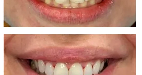 Dr. Sergio Garza González, consultorio dental en Monterrey, Nuevo León