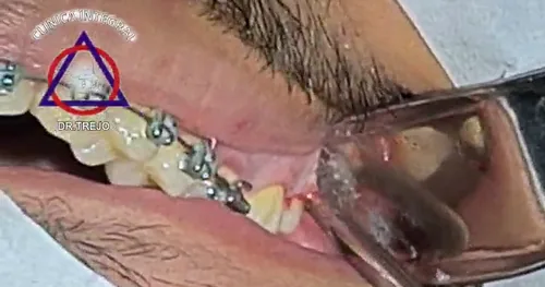 Clínica Integral Dr Trejo. Cirugía Maxilofacial Y Odontología., consultorio dental en Mazatlán, Sinaloa