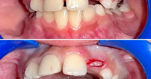 Dental Mouth, consultorio dental en Mazatlán, Sinaloa
