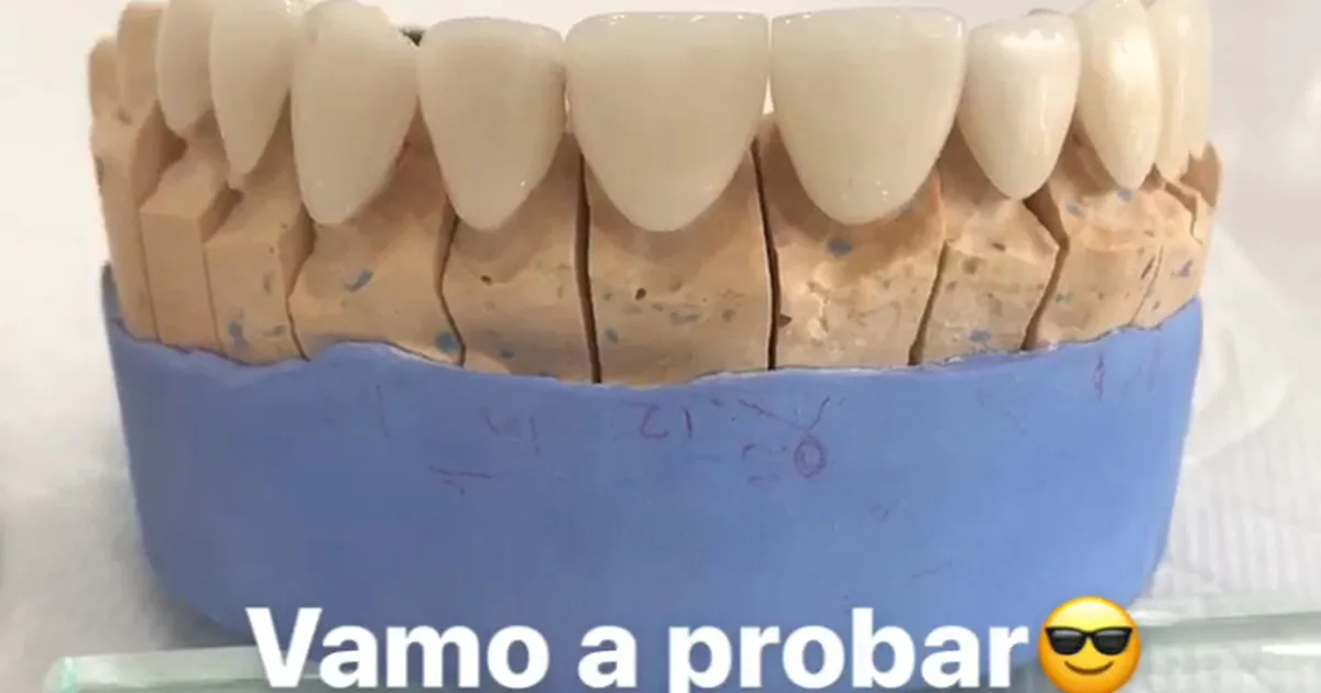 H&L Studio Dental – Dentistas Especialistas – Implantes Dentales (Dentista Matamoros)