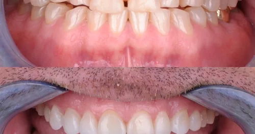 Dr.Jessiel Medina Advance Dental Care, consultorio dental en Nuevo Laredo, Tamaulipas