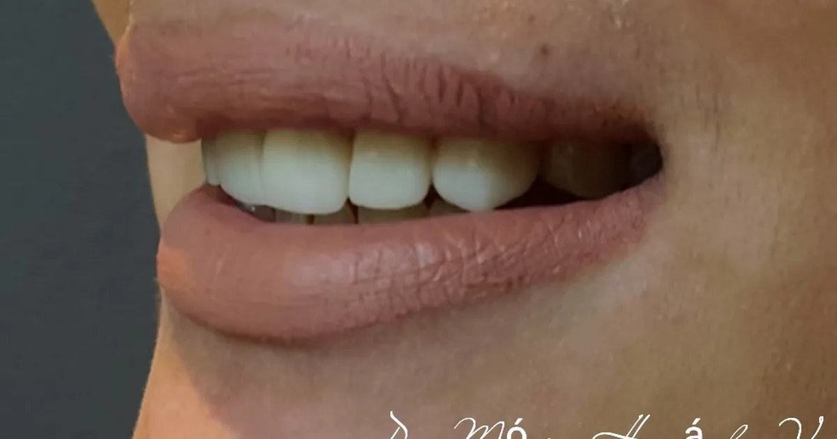 SPA DENTAL REYNOSA