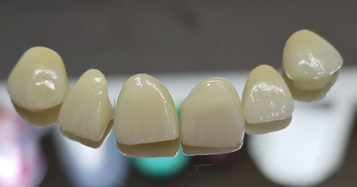 MOLAR CONSULTORIO DENTAL 24HRS AGS