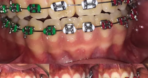 Dra. Ana Colín, consultorio dental en Álvaro Obregón, Ciudad de México