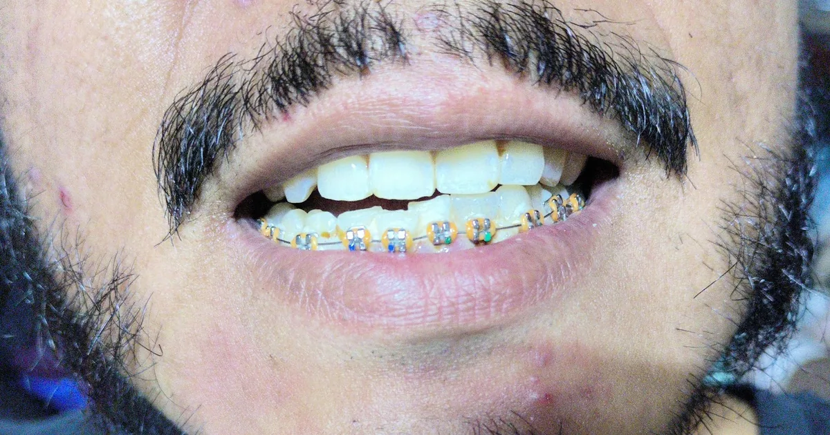 Consultorio Dental Dra.Araceli Fuentes Casanova