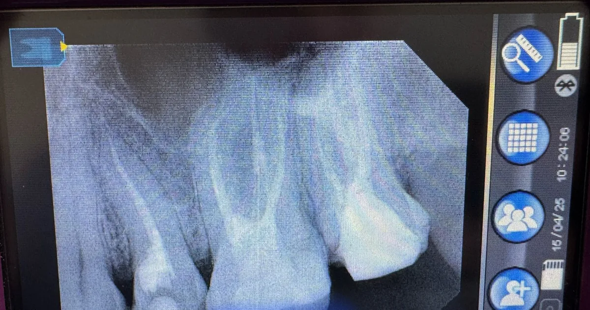 DENTICA
