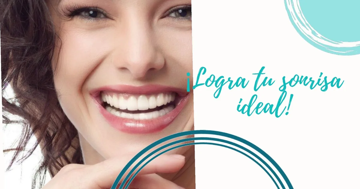 Bioestética Dental