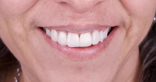Clínica Dental «Integra Dental Coyoacán», consultorio dental en Coyoacán, Ciudad de México