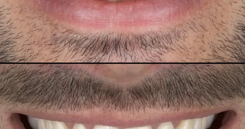 Dentista en Cdmx. Dr Yamil Romero, consultorio dental en Cuauhtémoc, Ciudad de México
