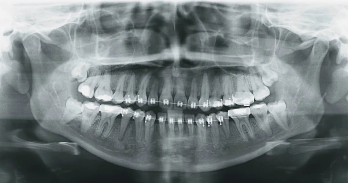 CLÍNICA DENTAL SONRISA DE ÁNGEL SPA
