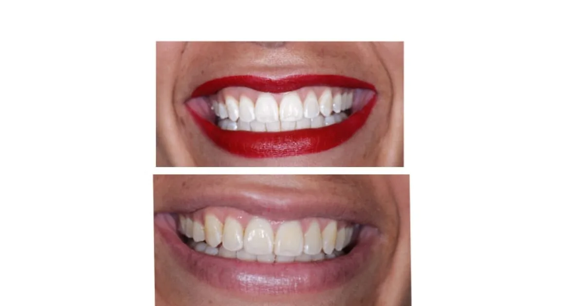 LOTODental