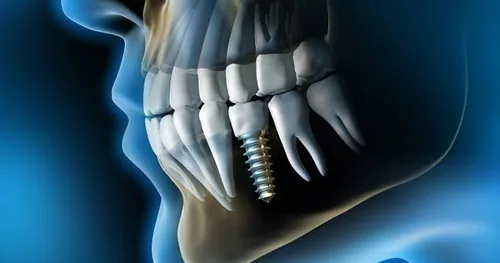 Clínica Dental – Hey Tooth, consultorio dental en Tlalpan, Ciudad de México