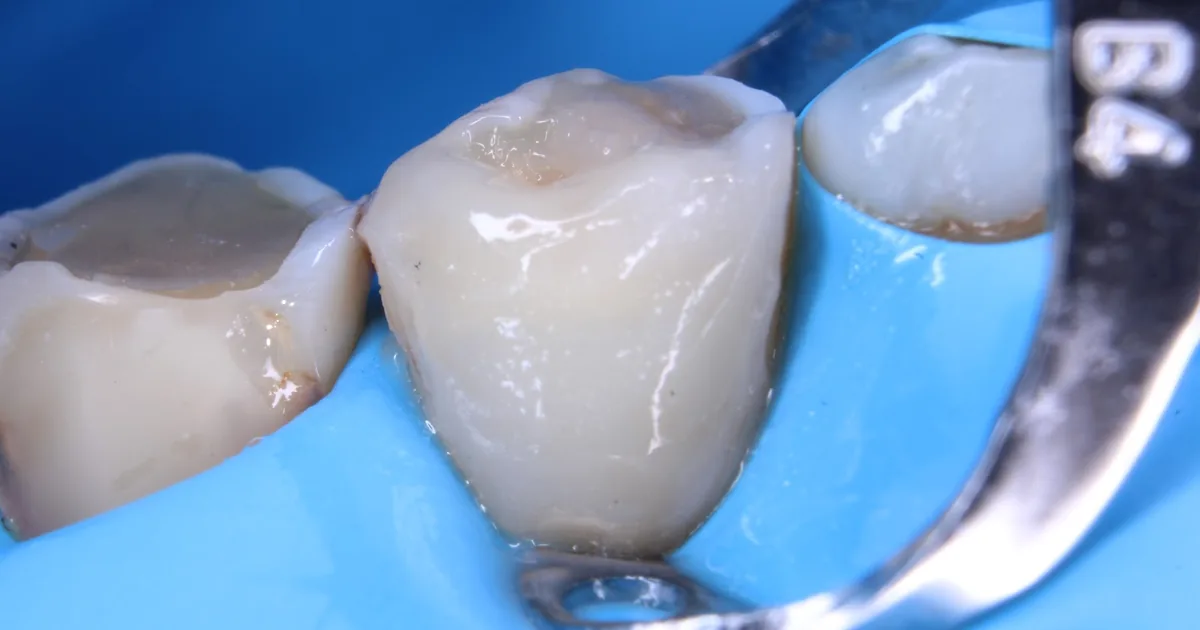 Dental Gaia CDMX (Dental Tourism)