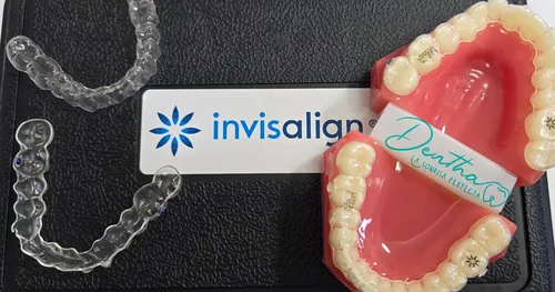 Clínica Dentha, consultorio dental en Xochimilco, Ciudad de México