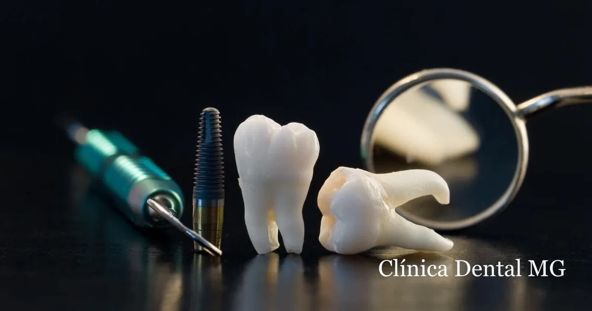 Clinica Dental mg Celaya