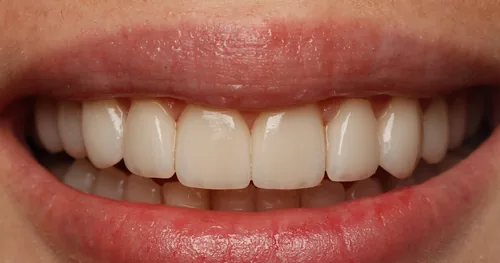 Beyond Dental Aesthetics, consultorio dental en Guadalajara, Jalisco