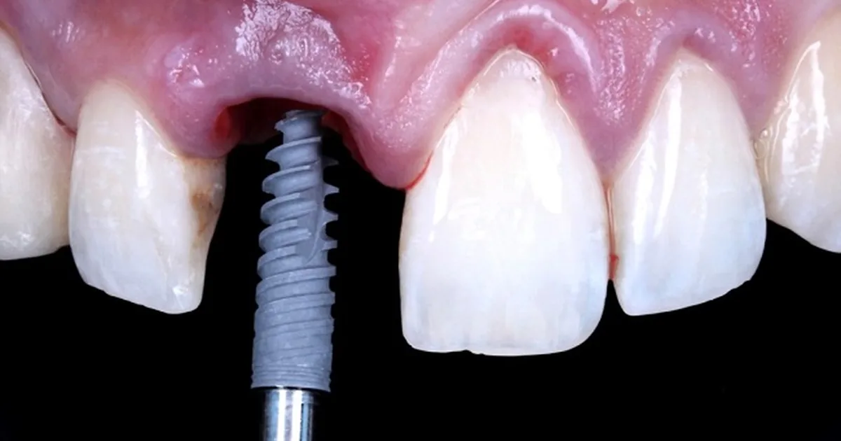 Consultorio Dental López & Mejorada