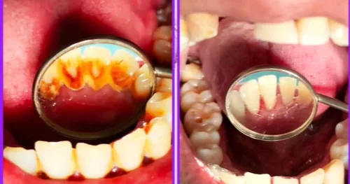 Clínica Dental Del Ángel, consultorio dental en Tlajomulco, Jalisco