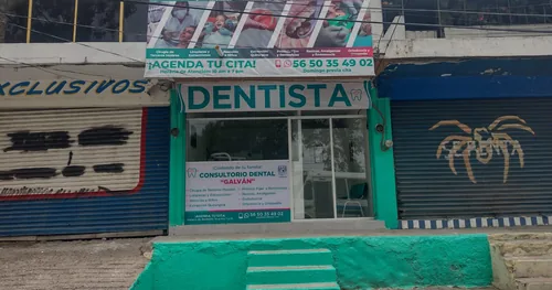 Dentista Ixtapaluca – Consultorio Dental «Galdent», consultorio dental en Ixtapaluca, Estado de México