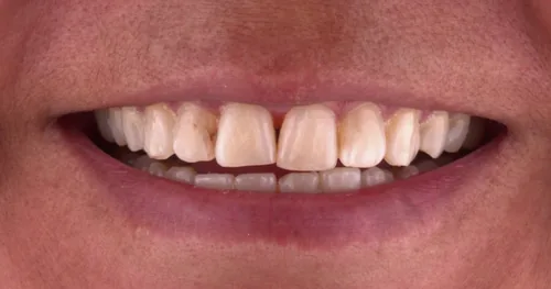 Consultorio Dental | G&G Arte Dental Ixtapaluca, consultorio dental en Ixtapaluca, Estado de México