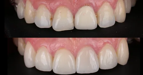 Clinica Dental, consultorio dental en Ecatepec de Morelos, Estado de México