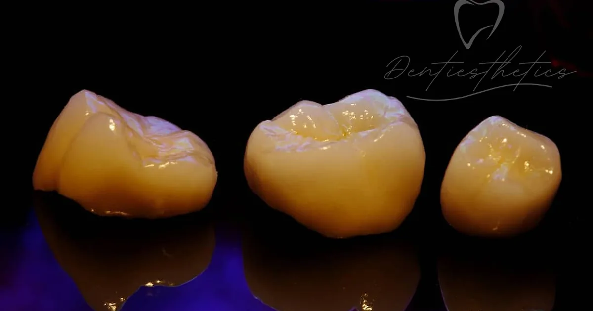 Dentiesthetics