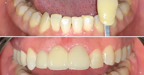 Dental inn Tecámac, consultorio dental en Tecámac, Estado de México