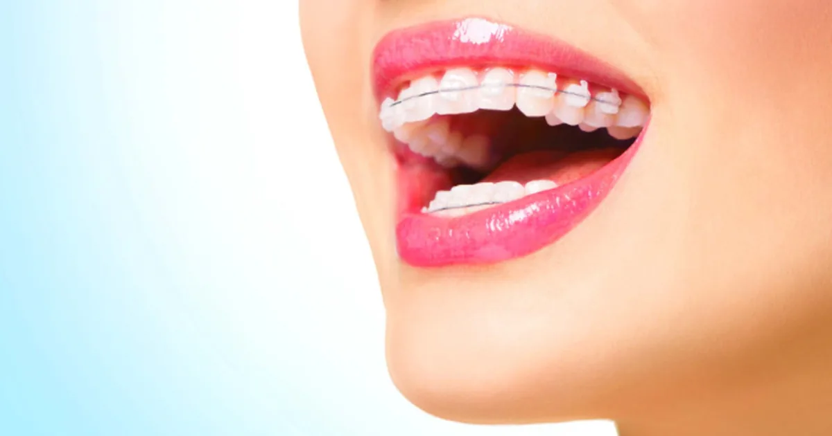 Jack´s Smile Dental Studio Dentista en Coacalco