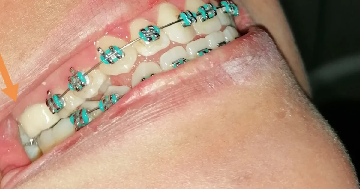 Centro de Atención Dental Integral