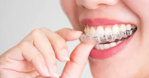 Clínica Dental SM – INVISALIGN PROVIDER (ORTODONCIA INVISIBLE), consultorio dental en Tlalnepantla, Estado de México