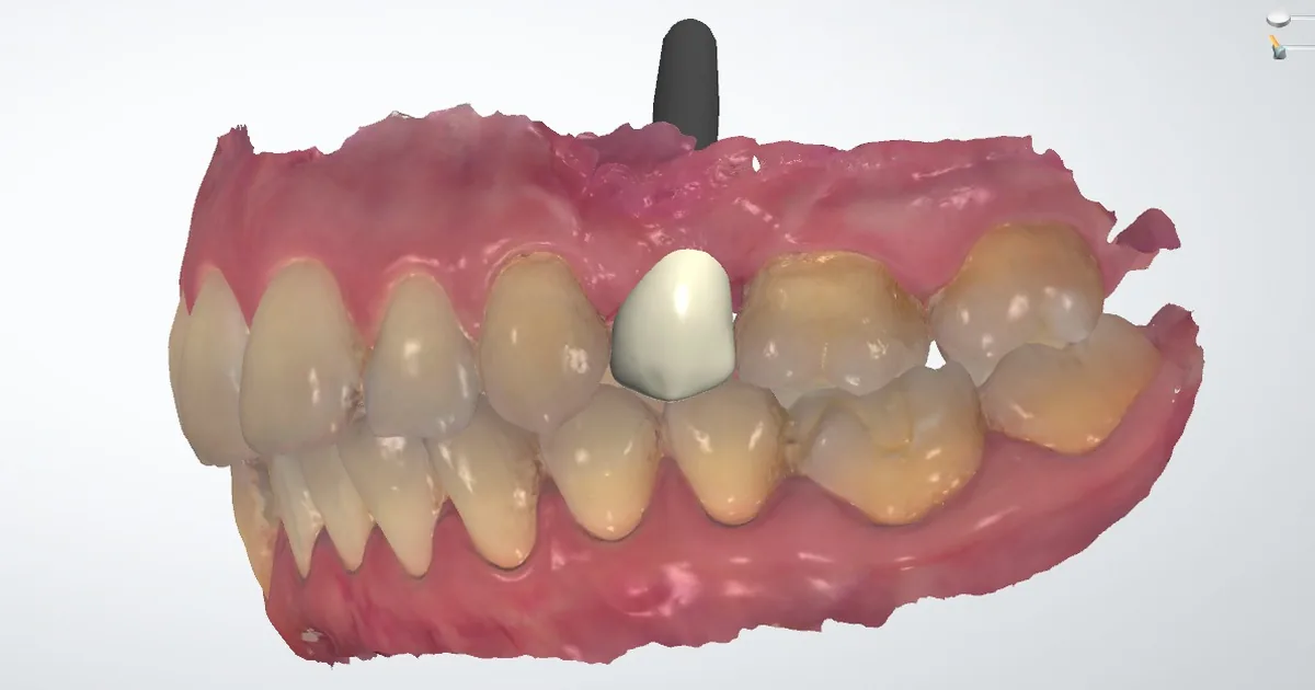 Dental Health MX