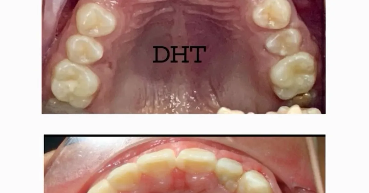DENTAL HEALTH TEXCOCO