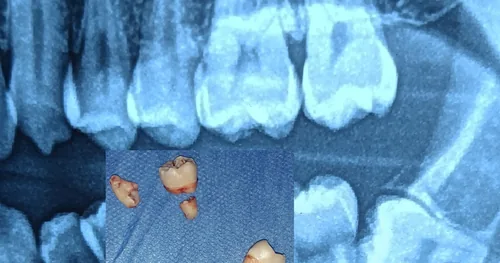 Dentista Adán Zamora ( Consultorio Dental Zamora ), consultorio dental en Cuautitlán Izcalli, Estado de México