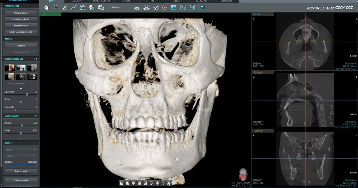 Imagen Dental