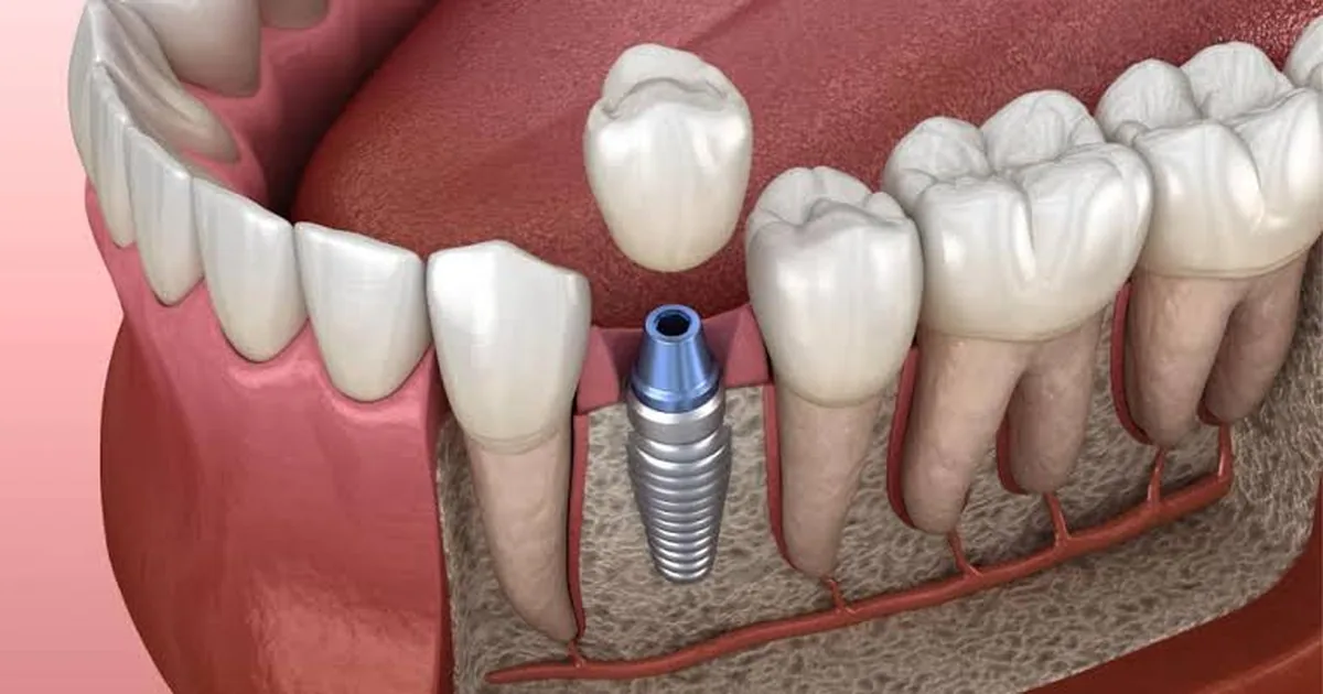 Dental Emporio