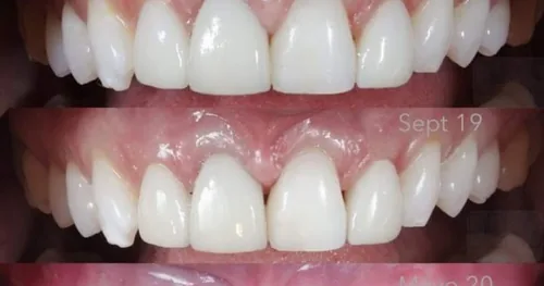 DENS, consultorio dental en Bahía de Banderas, Nayarit