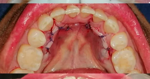 Clínica Dentaluz, consultorio dental en Querétaro, Querétaro