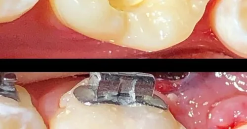 INNOVACION DENTAL Consultorio dental, consultorio dental en Querétaro, Querétaro