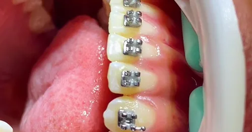 Dental Care Center Tuxtla, consultorio dental en Tuxtla Gutiérrez, Chiapas