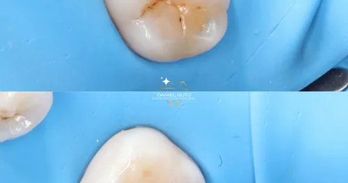 Odontologo Daniel Abarca Gutu, consultorio dental en Tuxtla Gutiérrez, Chiapas