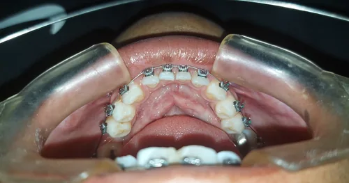 Centro Odontológico RG Dr. David Ruiz Gutierrez, consultorio dental en Tuxtla Gutiérrez, Chiapas