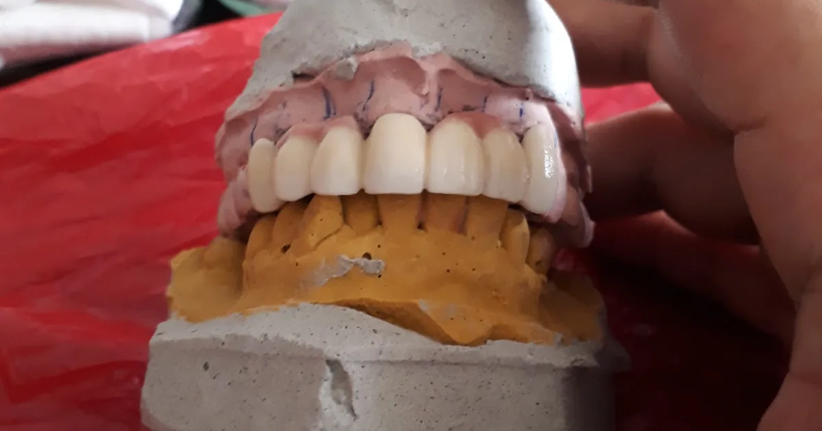 Dental Serrano: Dentista Ortodoncia Cirugía