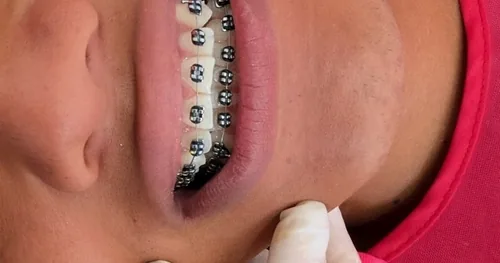 Kamaktli Consultorio Dental, consultorio dental en Acapulco, Guerrero
