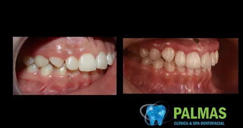 Dentista en Chilpancingo- Clínica Dental Palmas, consultorio dental en Chilpancingo, Guerrero