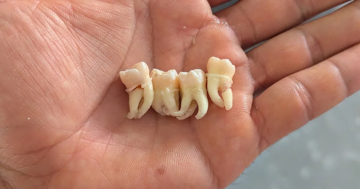 Bee Dental Health