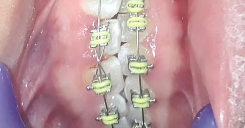 Magenta Clínica Dental, consultorio dental en Morelia, Michoacán